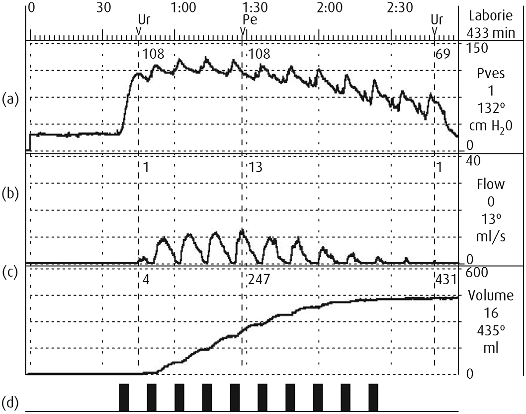 Neuromuscular electrical stimulation: (a) quadriceps and (b) diaphragm.