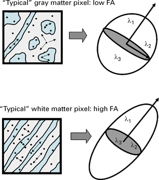 Diffusion Tensor Imaging In Developmental Clinical Neuroscience Chapter 19 Neuroimaging In Developmental Clinical Neuroscience