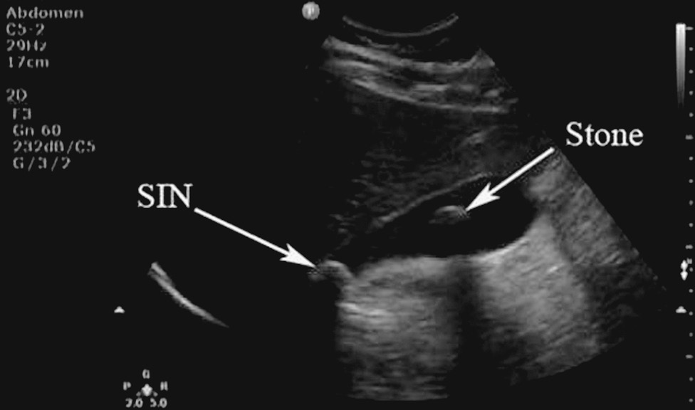 Gastrointestinal emergencies in the elderly (Chapter 21