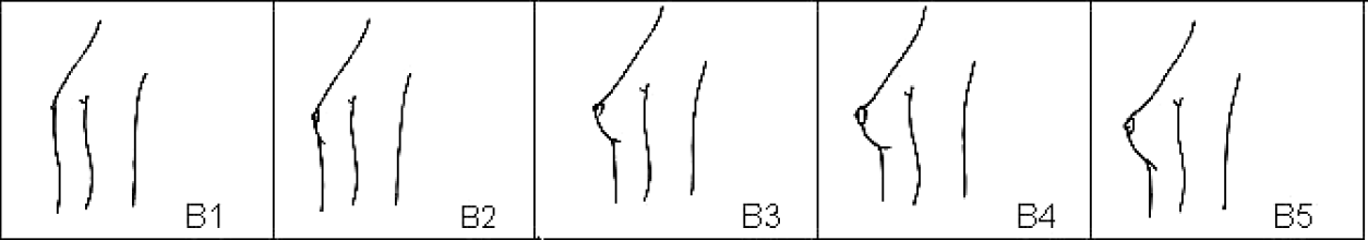 This line drawing of the Tanner Stages maturation of women's breasts