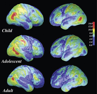 Morphological development of the brain: what has imaging told us 