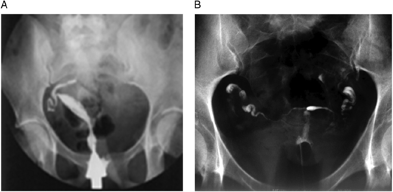 Benign Gynecology Section 2 Ultrasonography In Gynecology Benign Gynecology Section 2 Ultrasonography In Gynecology