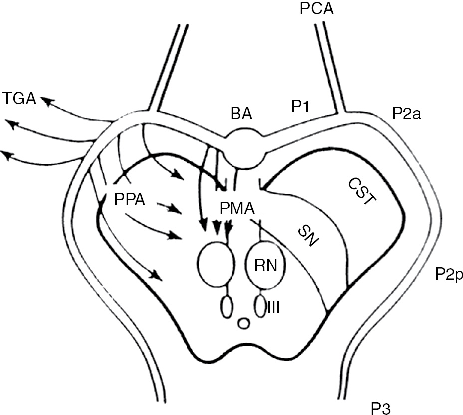 posterior cerebral artery territory