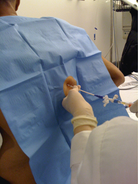 Procedural ultrasound (Section 2) - Manual of Emergency and Critical Care Ultrasound