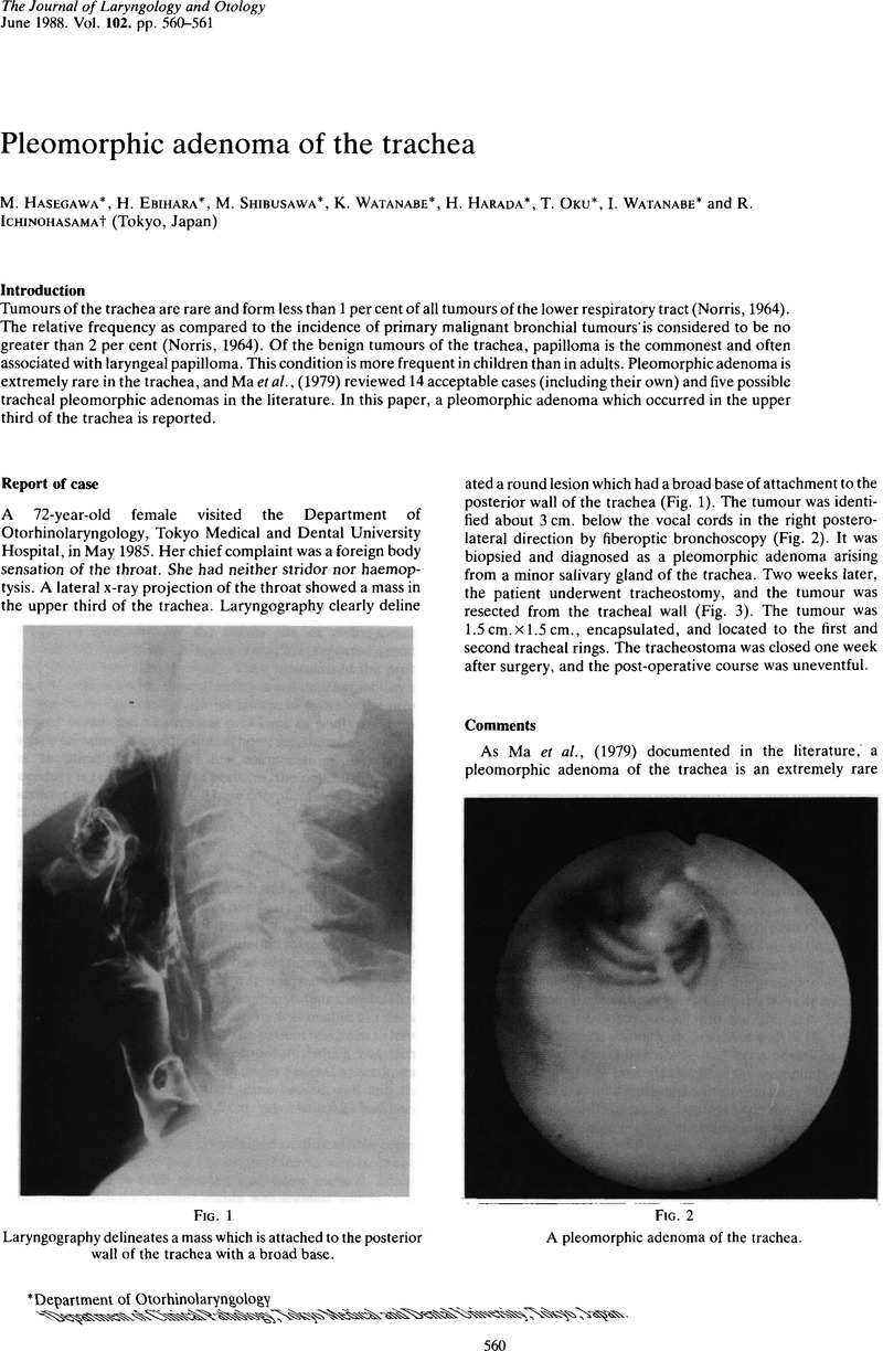 pleomorphic adenoma pdf Prostatitis fájdalom a fenékben