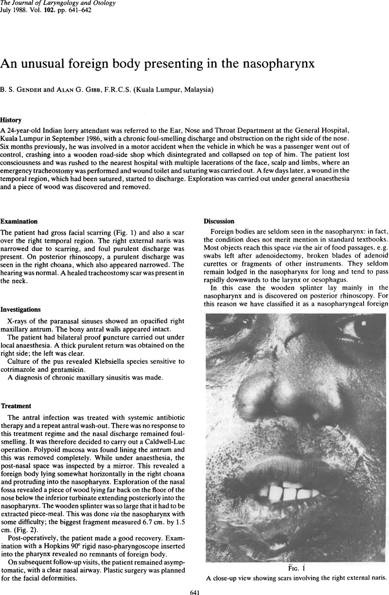 Bilateral Foreign Body Bronchus  Indian Journal of Otolaryngology and Head  & Neck Surgery