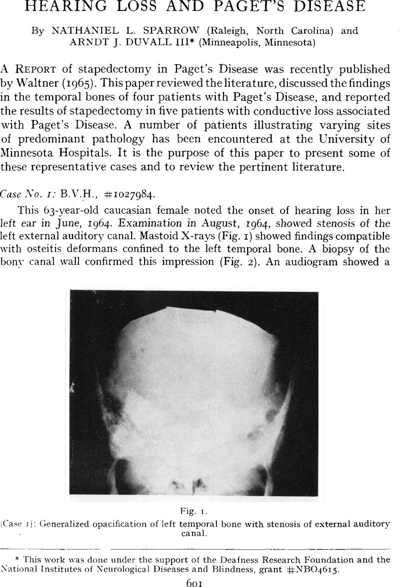 hearing-loss-and-paget-s-disease-the-journal-of-laryngology-otology