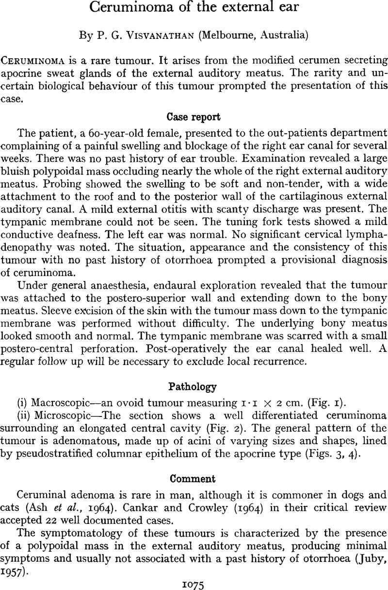 Ceruminoma of the external ear | The Journal of Laryngology & Otology ...