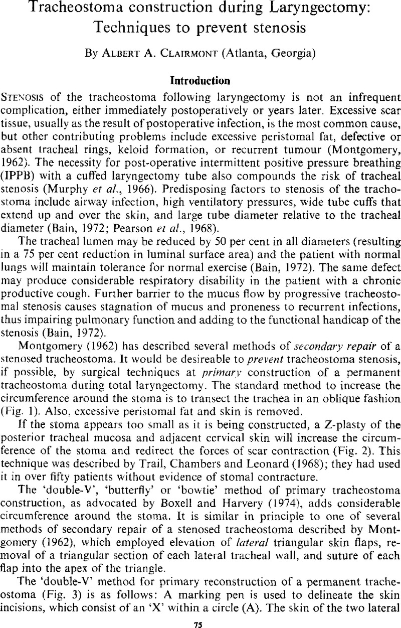 Tracheostoma construction during Laryngectomy: Techniques to prevent ...