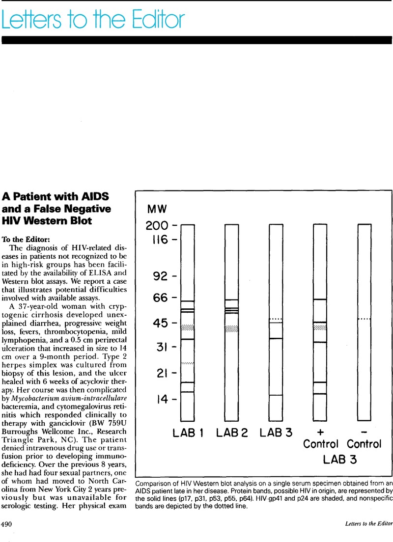 A Patient With AIDS And A False Negative HIV Western Blot Infection   FirstPage S0195941700067527a 