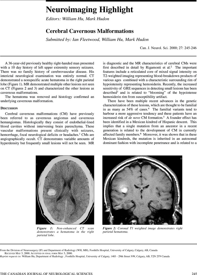 Cerebral Cavernous Malformations Canadian Journal Of Neurological Sciences Cambridge Core