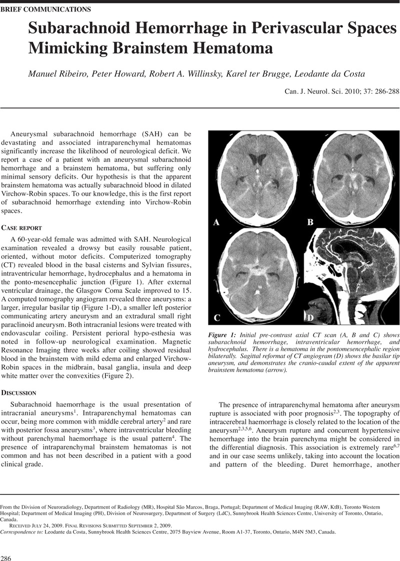 Intraparenchymal Hemorrhage Vs Subarachnoid Hemorrhage