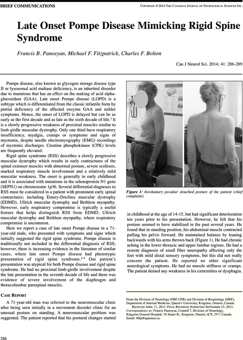 pompe disease research paper