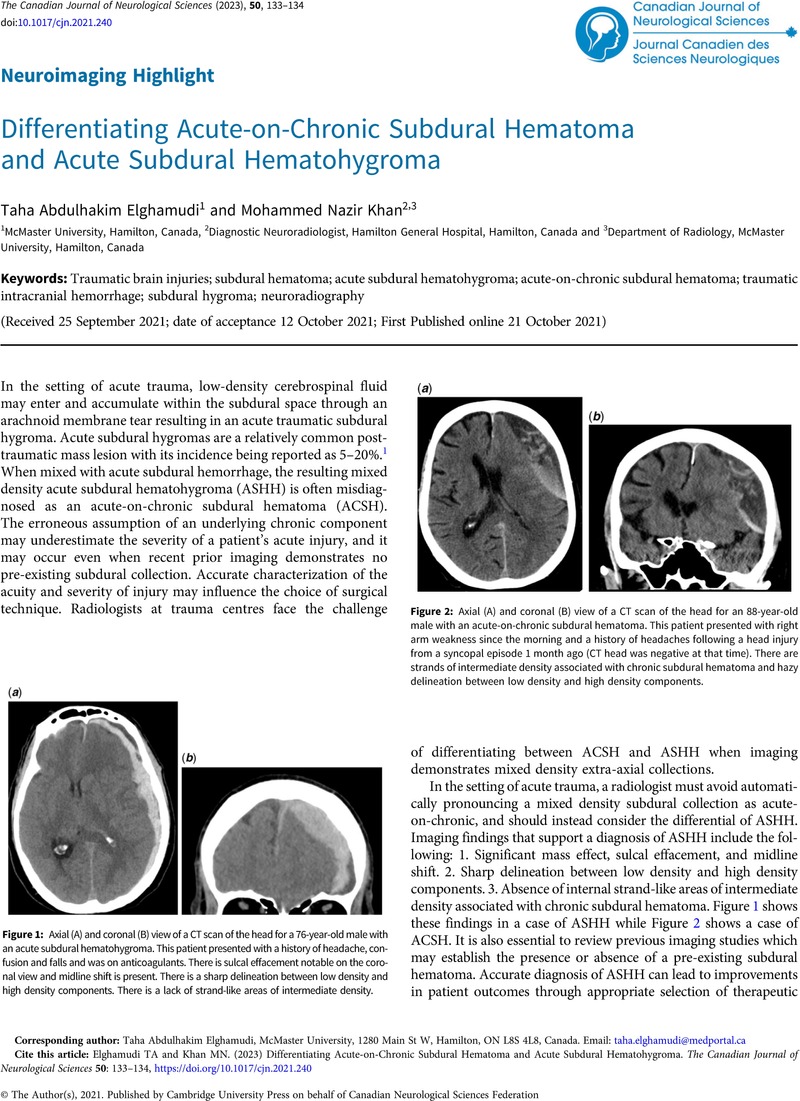 Differentiating Acute On Chronic Subdural Hematoma And Acute Subdural