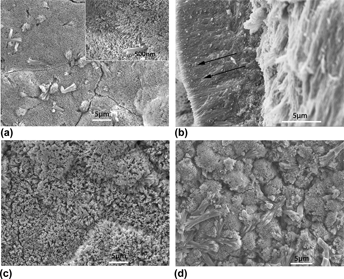 Repairing human tooth enamel with leucine-rich amelogenin peptide ...