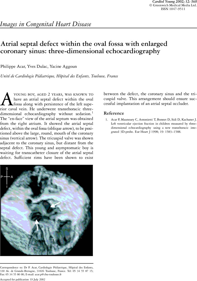 atrial-septal-defect-within-the-oval-fossa-with-enlarged-coronary-sinus