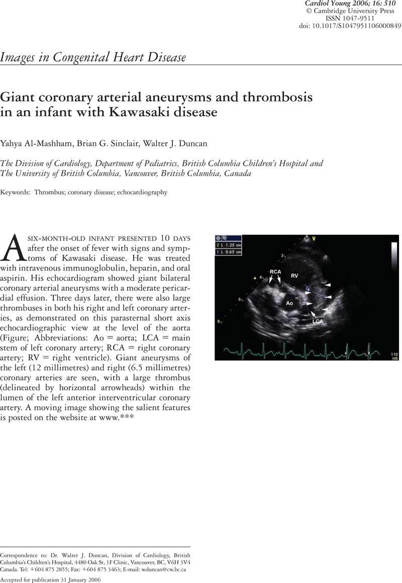 Giant Coronary Arterial Aneurysms And Thrombosis In An Infant With ...