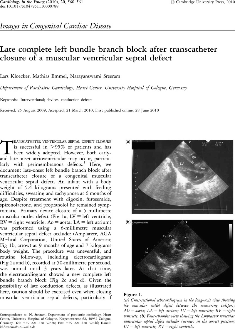 Late complete left bundle branch block after transcatheter closure of a ...