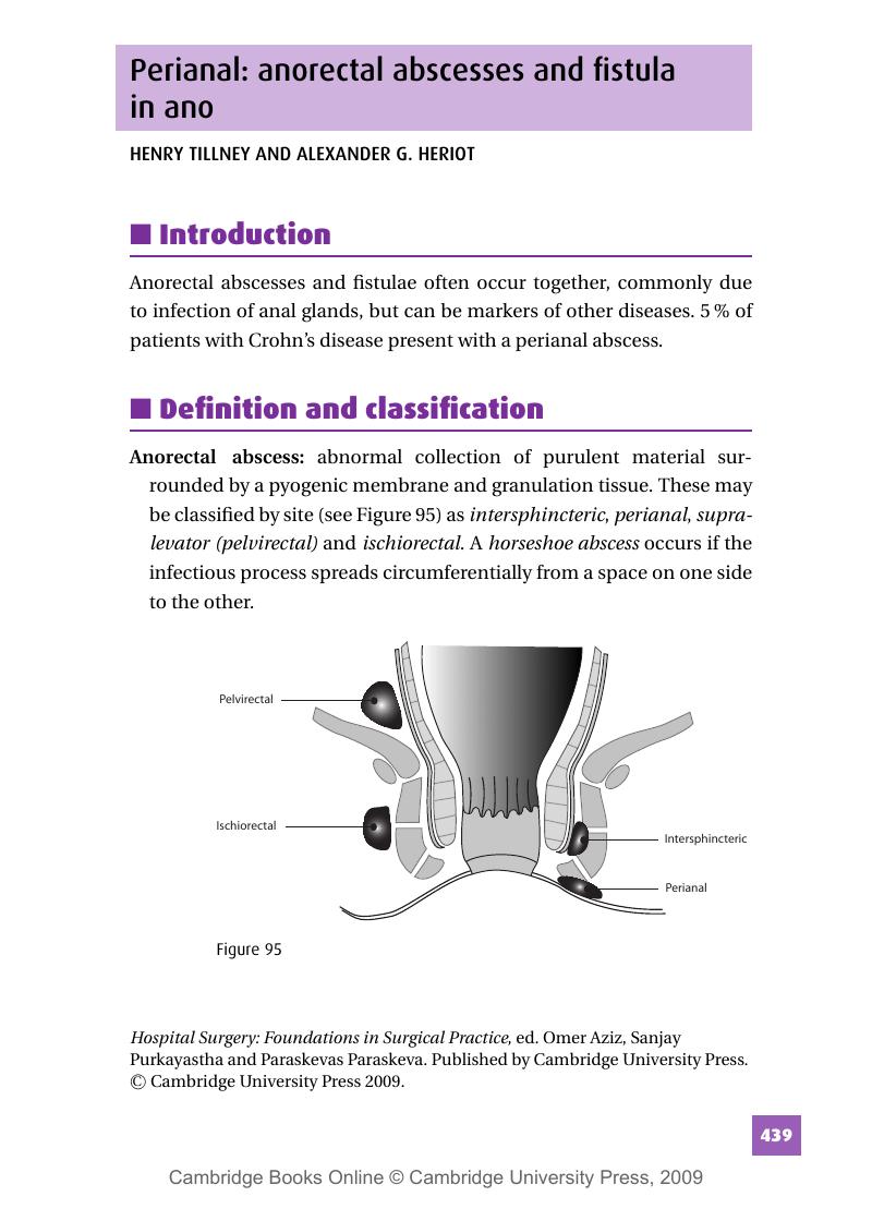 Perianal Anorectal Abscesses And Fistula In Ano Hospital Surgery