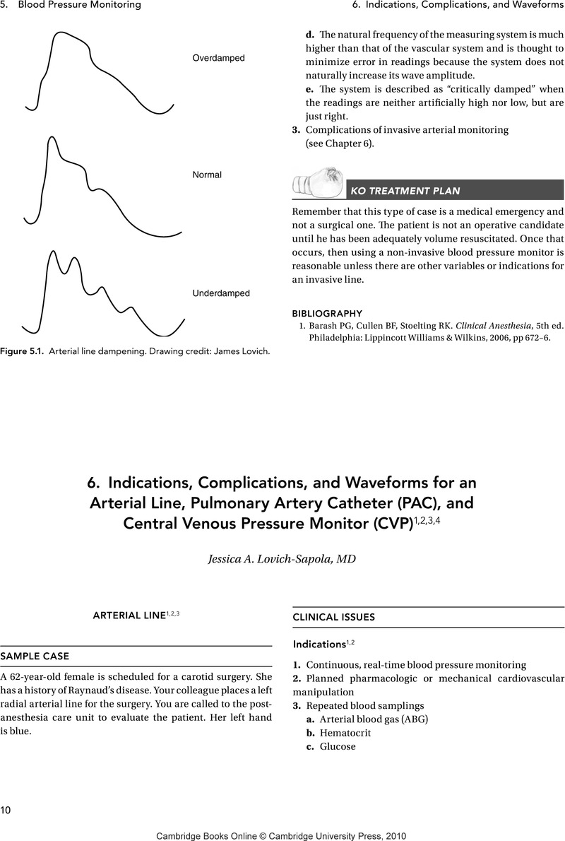 indications-complications-and-waveforms-for-an-arterial-line