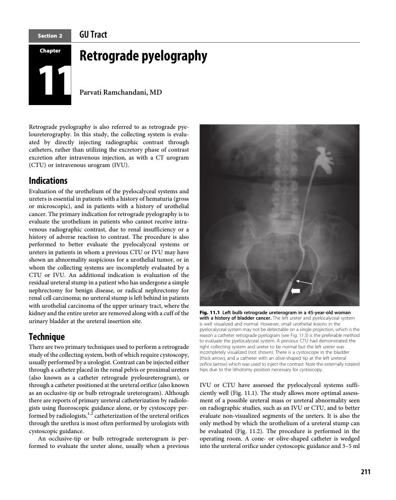 Retrograde pyelography (Chapter 11) Practical Fluoroscopy of the GI