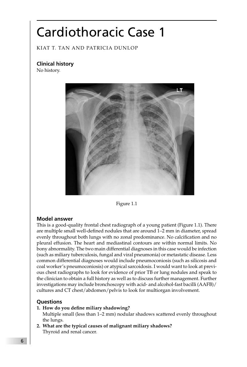 Cardiothoracic And Vascular Radiology Chapter 1 Final Frcr 2b Viva