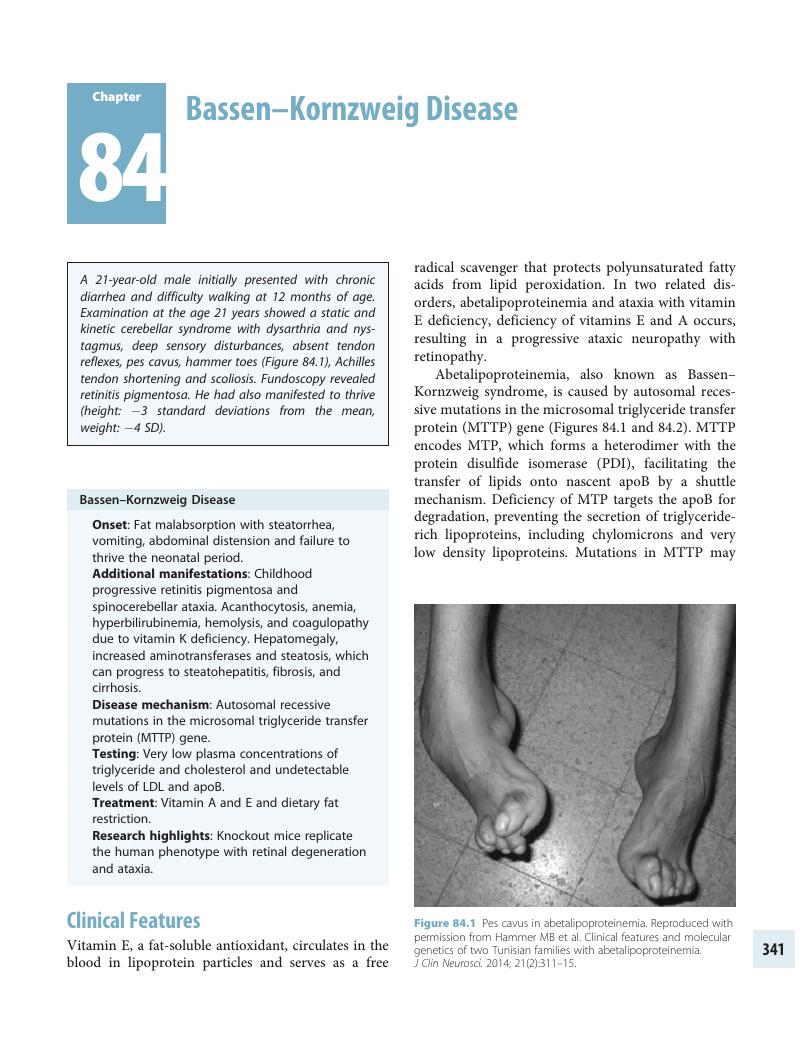 Bassen-Kornzweig syndrome and its repertorial rubrics |Homoeoscan ...