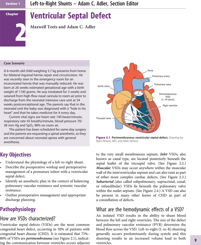 Left-to-Right Shunts (Section 1) - Congenital Cardiac Anesthesia