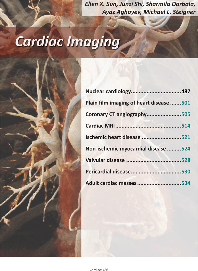 Cardiac Imaging (Chapter 7) - Core Radiology