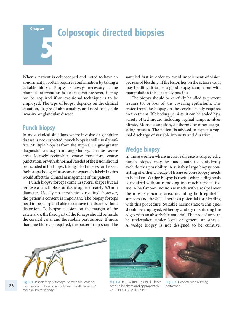 Colposcopic directed biopsies (Chapter 5) - Colposcopy