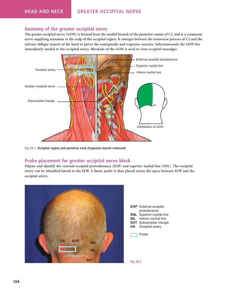 Greater occipital nerve - Sonoanatomy for Anaesthetists