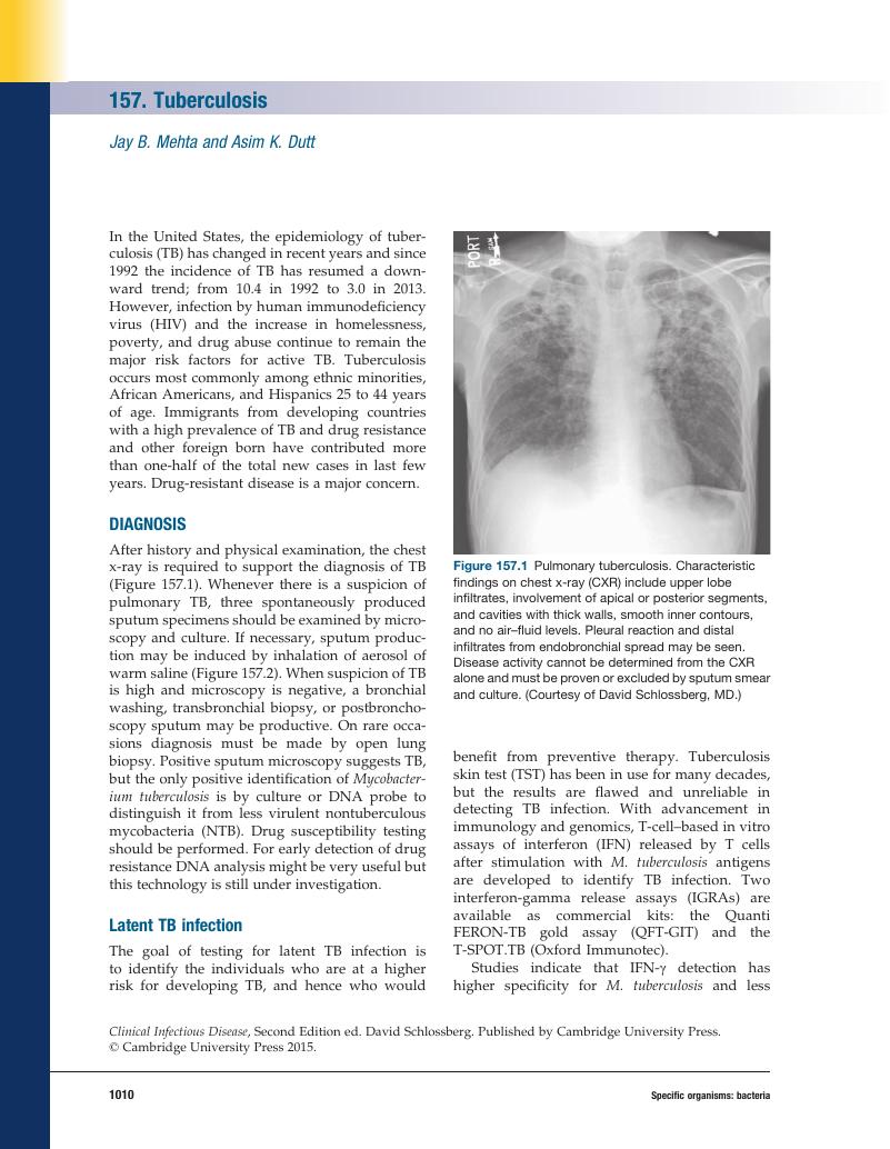 Tuberculosis (Chapter 157) - Clinical Infectious Disease