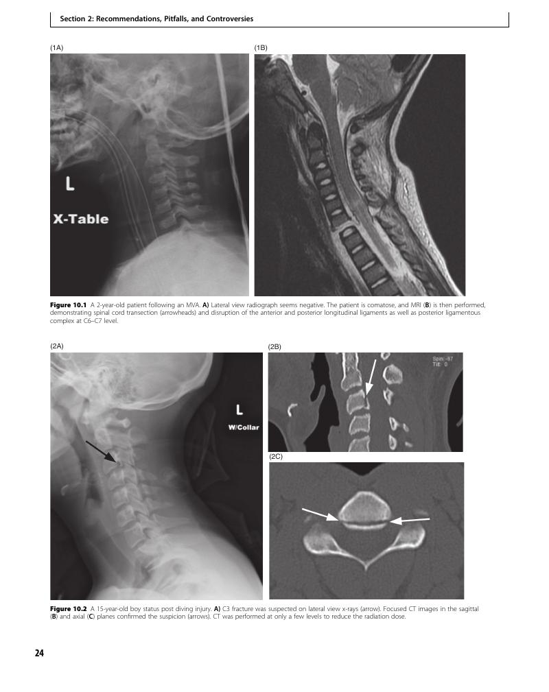 Role of Plain Films in Spine Trauma (Case 10) - Clinical Imaging of ...