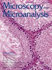 Microscopy and Microanalysis Volume 11 - Issue 4 -