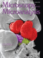 Microscopy and Microanalysis Volume 12 - Issue 5 -