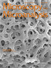 Microscopy and Microanalysis Volume 15 - Issue 1 -