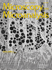 Microscopy and Microanalysis Volume 15 - Issue 2 -