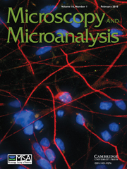 Microscopy and Microanalysis Volume 16 - Issue 1 -