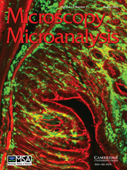 Microscopy and Microanalysis Volume 17 - Issue 4 -