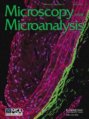 Microscopy and Microanalysis Volume 22 - Issue 3 -