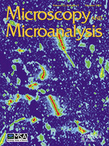 Microscopy and Microanalysis Volume 22 - Issue 5 -