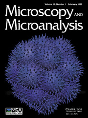 Microscopy and Microanalysis Volume 28 - Issue 1 -