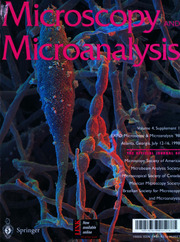 Microscopy and Microanalysis Volume 4 - Issue S1 -  EXPO: Microscopy and Microanalysis 1998 Atlanta, Georgia July 12-16, 1998