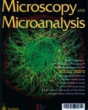 Microscopy and Microanalysis Volume 5 - Issue S1 -  EXPO: Microscopy and Microanalysis 1999 Portland, Oregon August 1-5, 1999