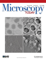 Microscopy Today Volume 18 - Issue 4 -
