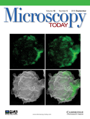 Microscopy Today Volume 18 - Issue 5 -