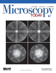 Microscopy Today Volume 20 - Issue 2 -