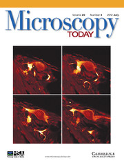 Microscopy Today Volume 20 - Issue 4 -