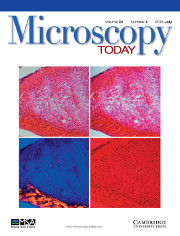 Microscopy Today Volume 24 - Issue 4 -